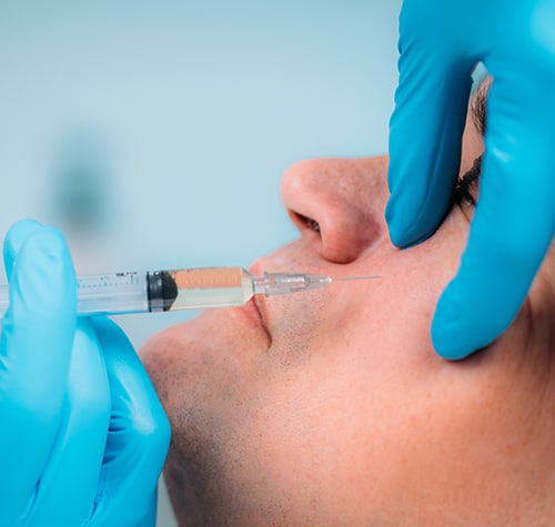 Sculptra Injection Men